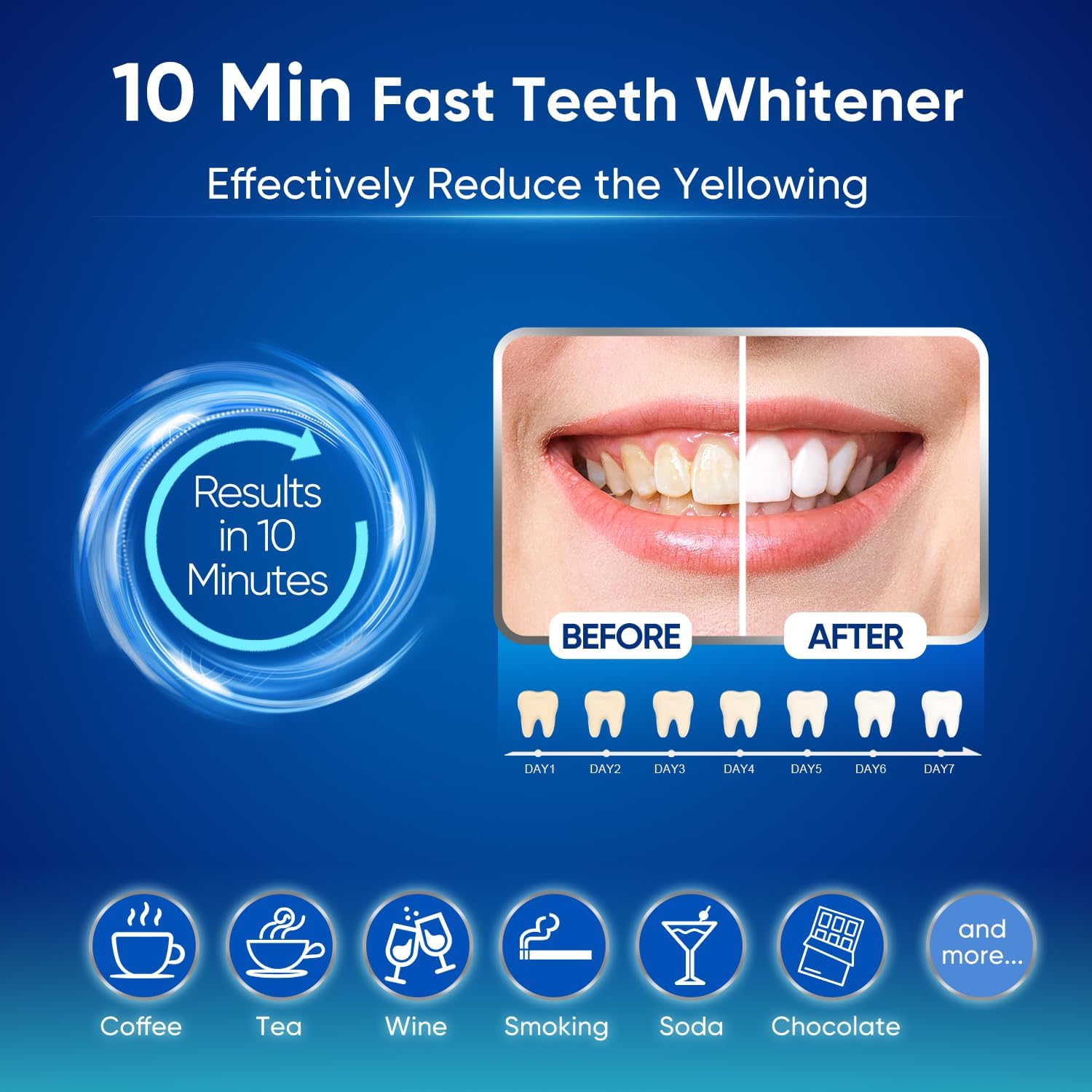 MySmile Advanced Teeth Whitening Kit with LED Accelerator, 10-Minute Daily Treatment - Image 5