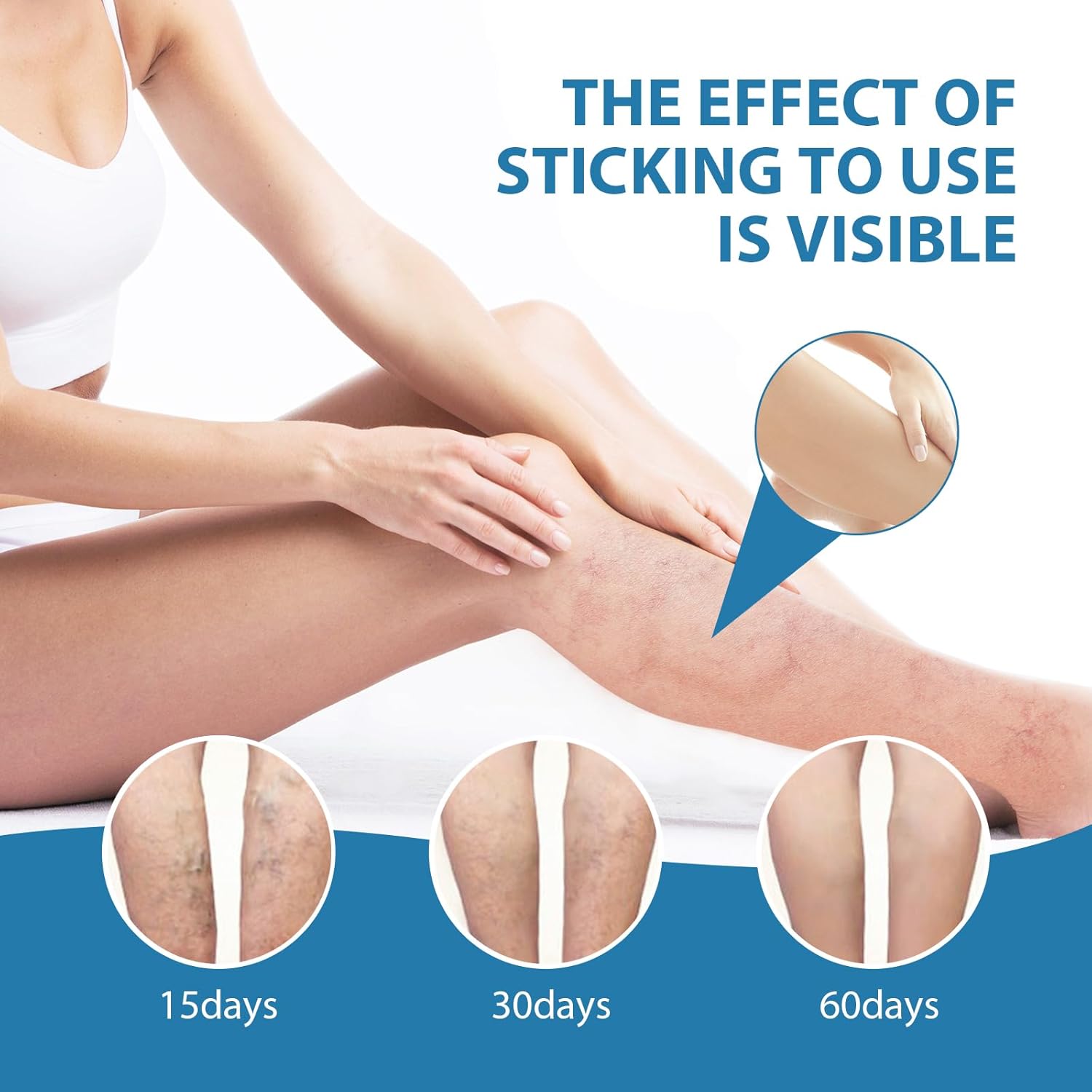Herbal Varicose and Spider Veins Treatment Cream for Legs, 0.7 Oz - Image 6