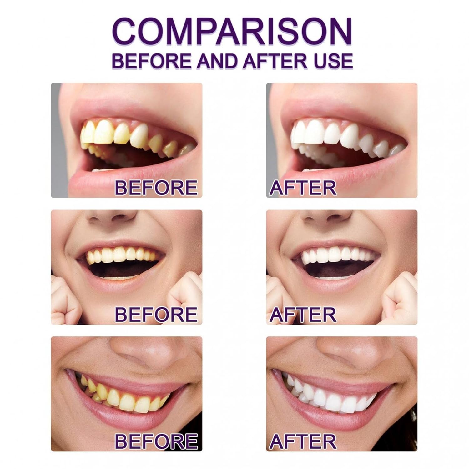 Teeth Whitening Pen, Teeth Stain Remover to Whiten Teeth, Effective&Painless, No Sensitivity, Travel-Friendly, Easy to Use, Beautiful White Smile, Oral Care, 1PC/4PCS - Image 6