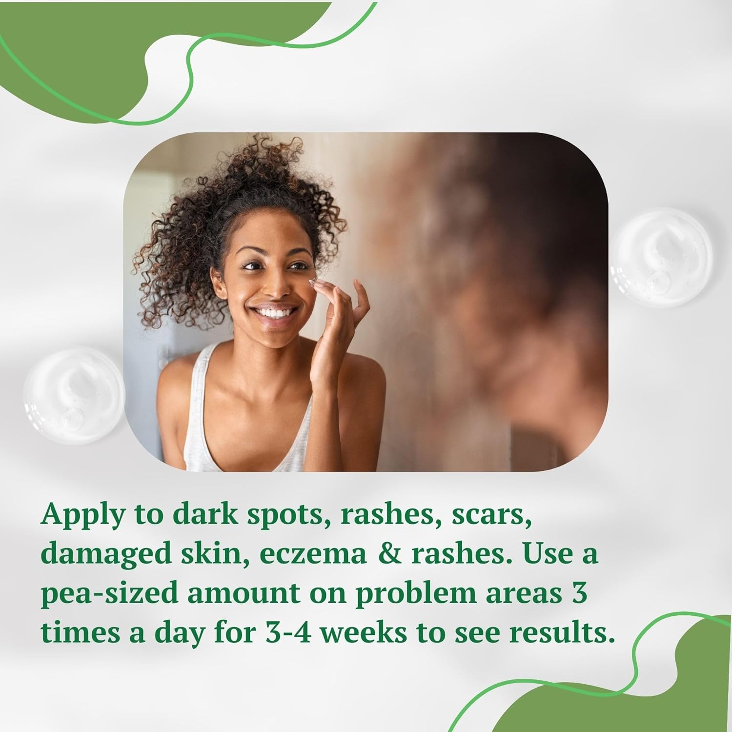 Soothing Aloe Vera Face and Body Cream for Dark Blemishes and Scars 4 oz - Image 4