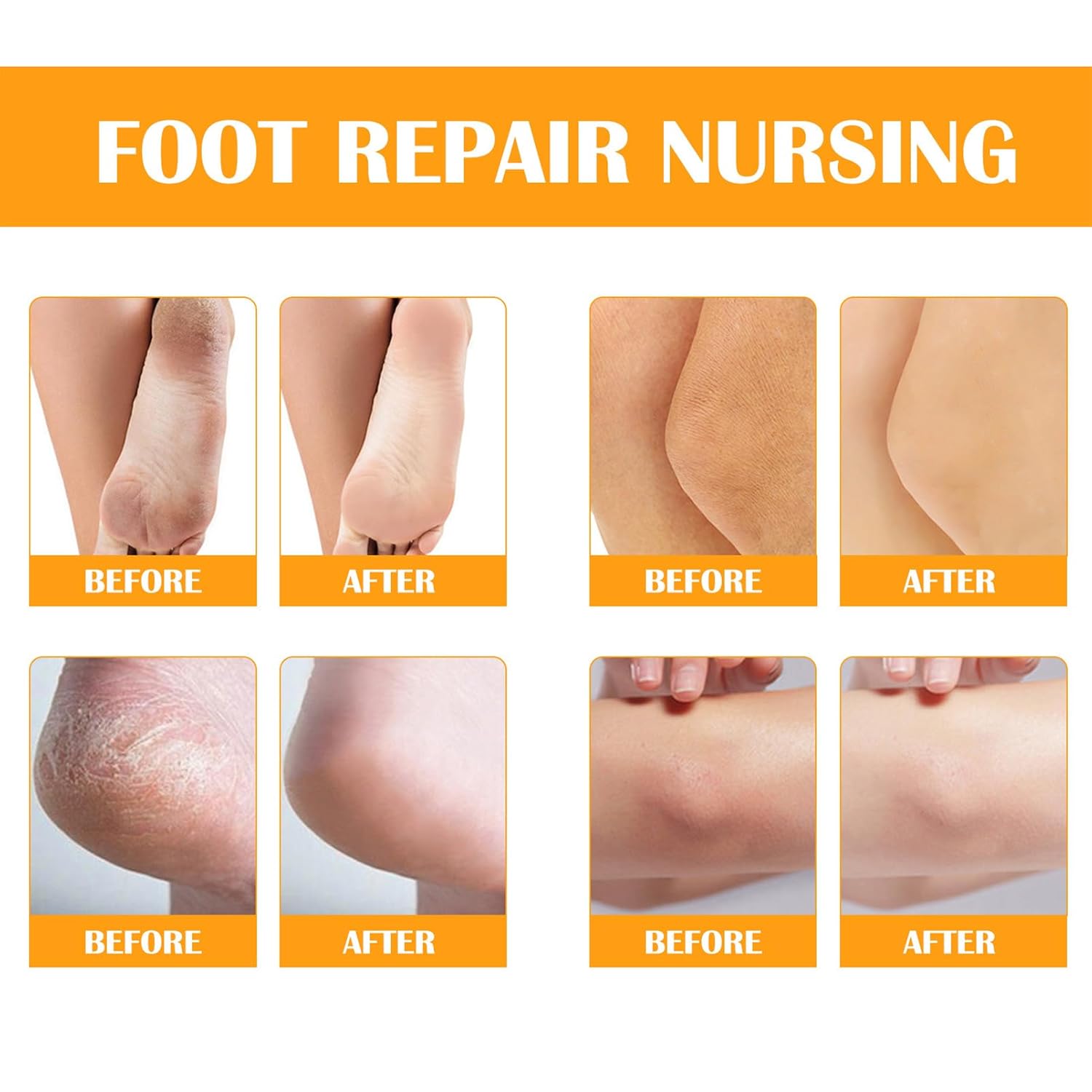 200ml Foot Peeling Spray Oil for Dead Skin Removal and Callus Treatment with Exfoliating Mask - Image 5