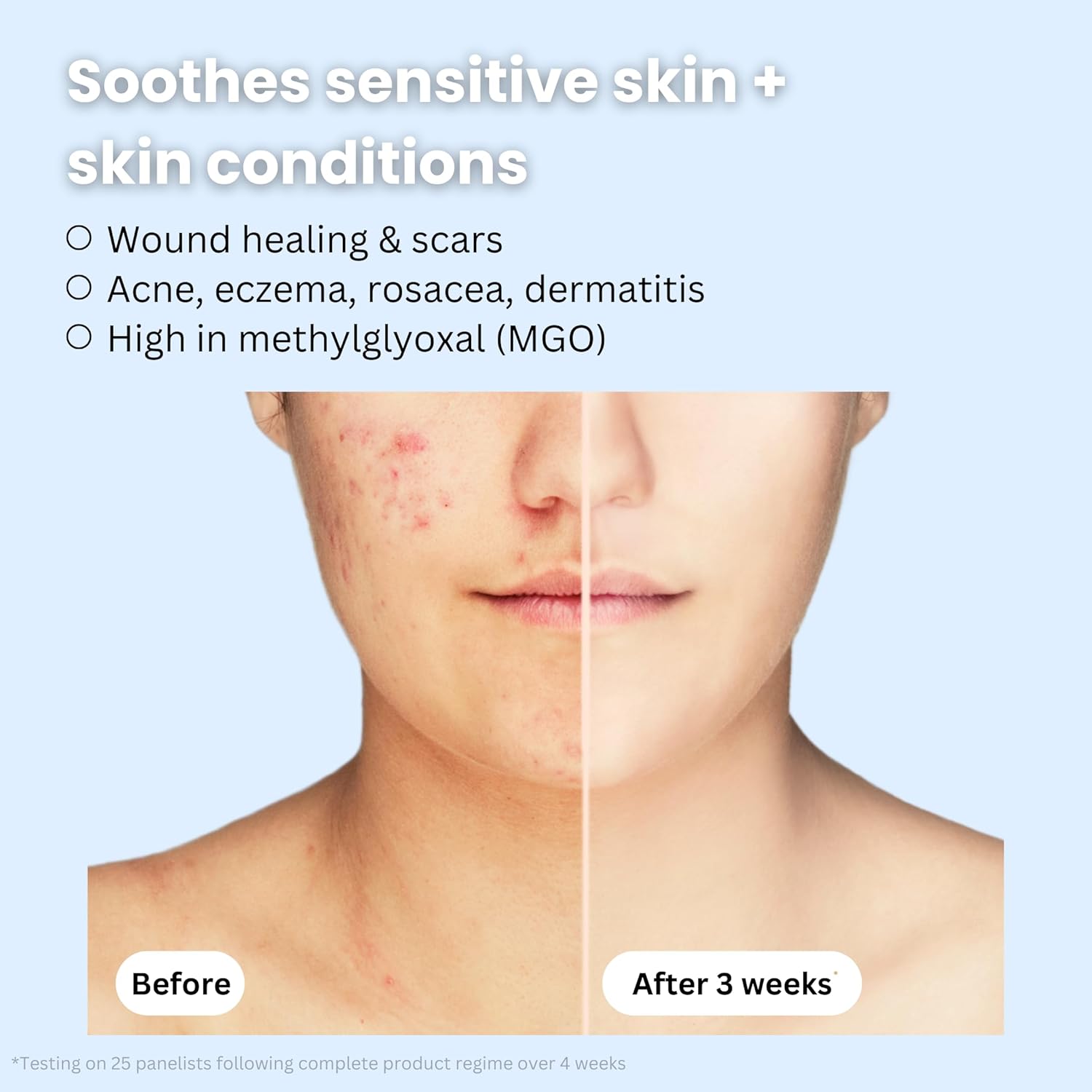 Organic Bee Venom + Manuka Day Barrier Face Moisturizer | Hydrating, Anti-Wrinkle, Collagen Booster | 2.5 month supply, 2oz/60ml | Made in New Zealand - Image 5