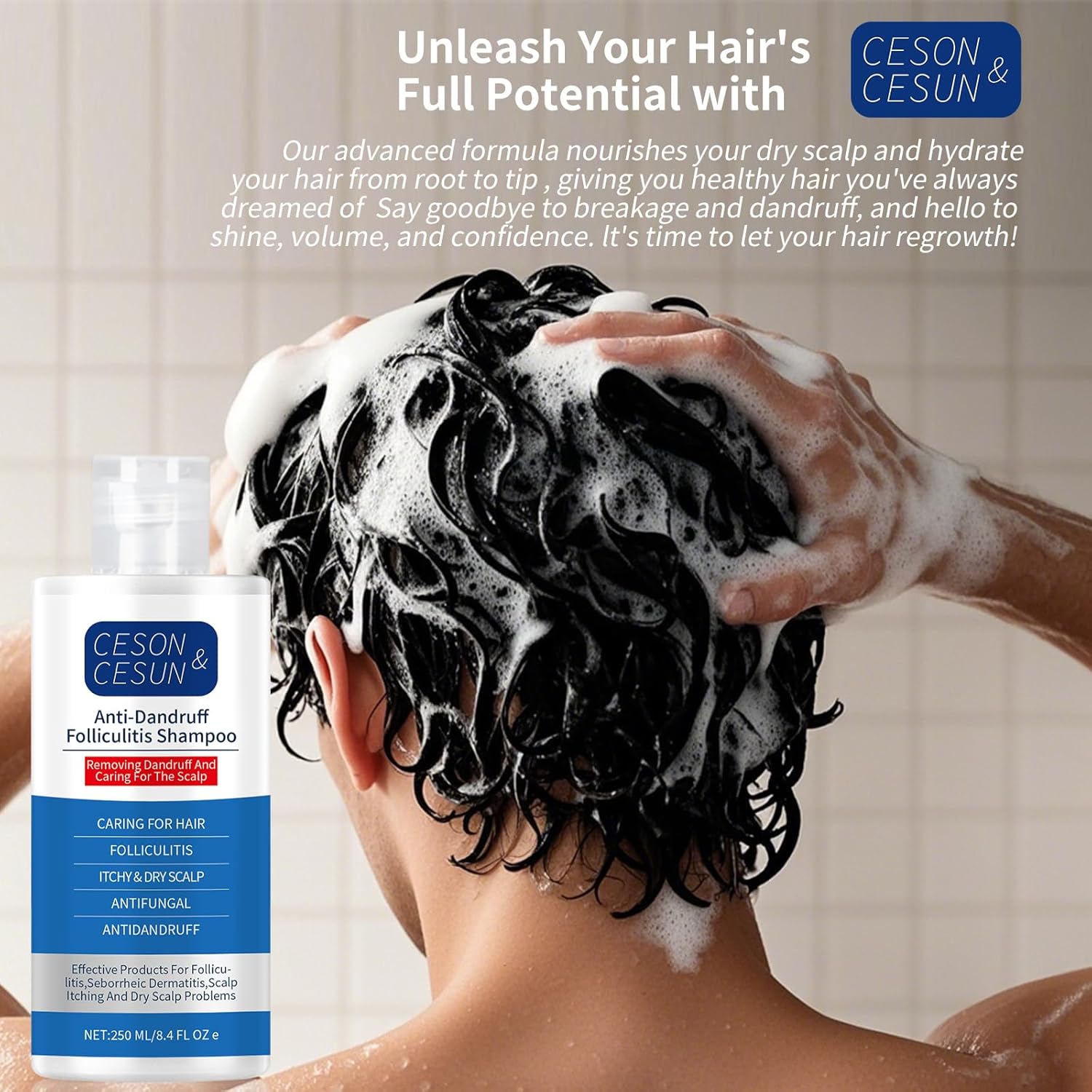 Ceson&Cesun Anti-Fungal/Anti Dandruff 2 in 1 Shampoo for Folliculitis, Scalp Psoriasis & Seborrheic Dermatitis, Itchy & Dry Scalp Relief, Nourishes, Hydrates, Control Oil, Safe For Color-Treated Hair - Image 12