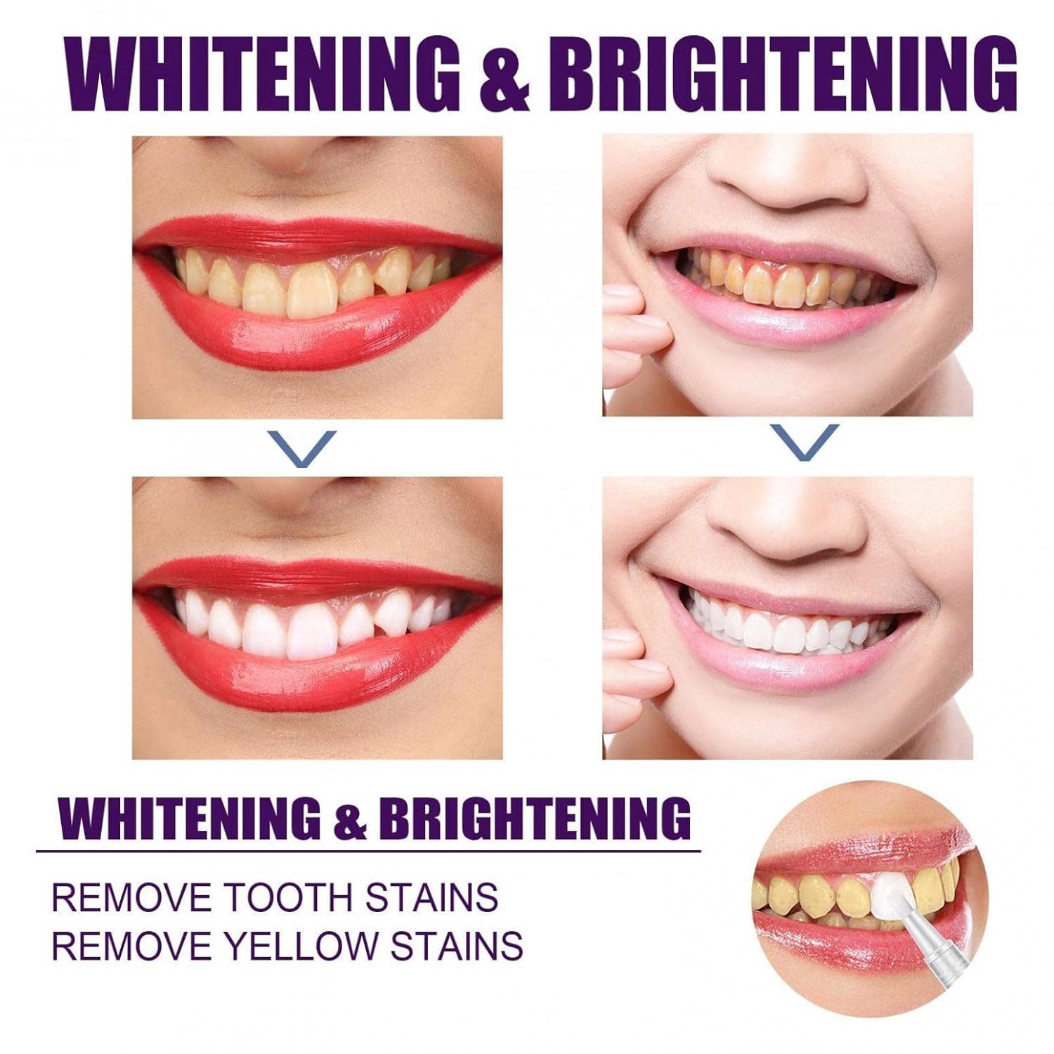 Teeth Whitening Pen, Teeth Stain Remover to Whiten Teeth, Effective&Painless, No Sensitivity, Travel-Friendly, Easy to Use, Beautiful White Smile, Oral Care, 1PC/4PCS - Image 4