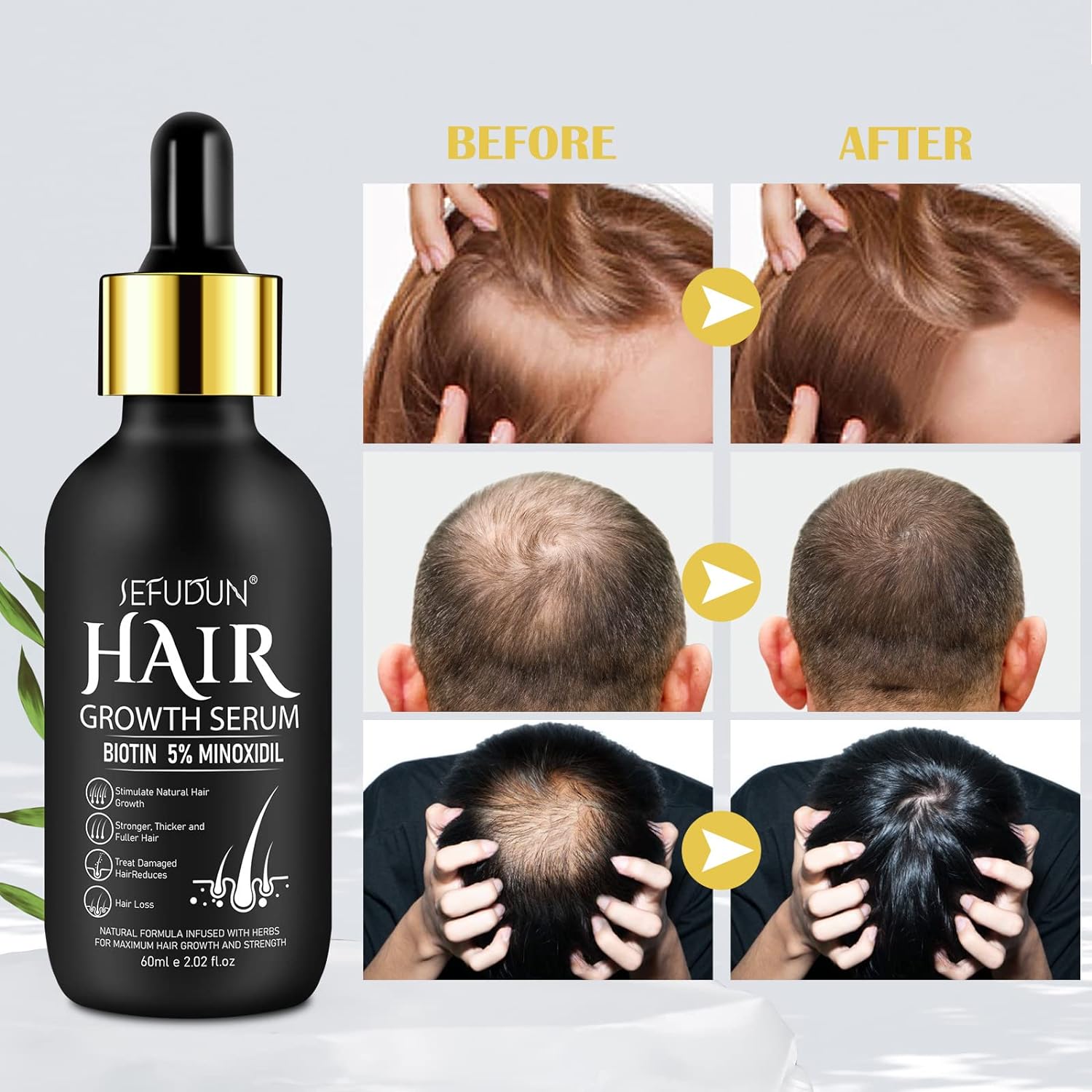 Minoxidil 5% Hair Growth Serum for Men and Women, 2.02 oz Bottle, Promotes Fuller Hair - Image 4