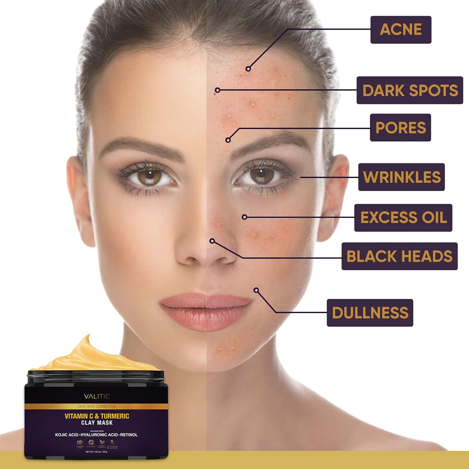 VALITIC Vitamin C & Turmeric Clay Mask - Dark Spot Corrector with Kojic Acid, Hyaluronic Acid & Retinol - Skin Care Routine for Minimizing Pores & Blackheads - with Applicator Brush - 100g - Image 6