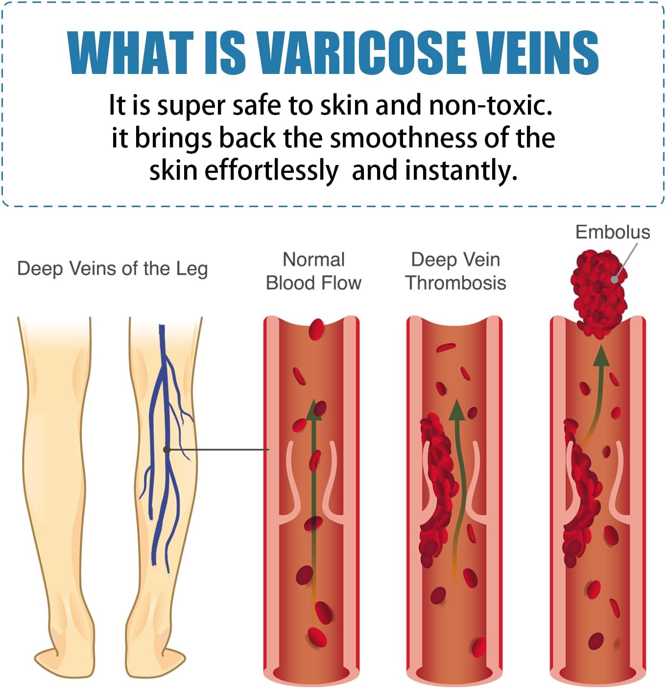 Herbal Varicose and Spider Veins Treatment Cream for Legs, 0.7 Oz - Image 5