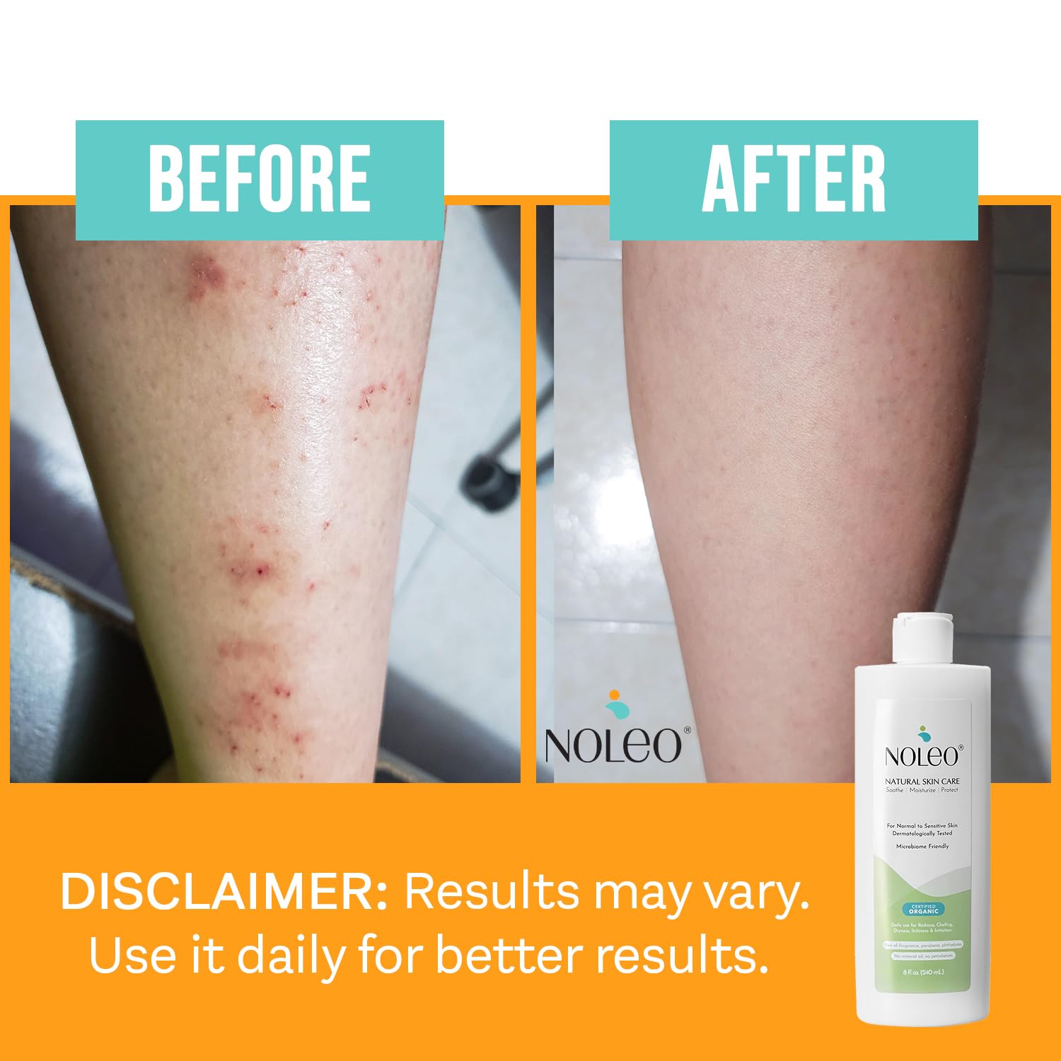 NOLEO Natural Skin Care – Deep Moisturizer for Sensitive Skin | Soothes Redness, Chafing & Irritation | Non-Toxic, EWG Verified, Organic | Face & Body Cream for Adults & Babies – 8oz - Image 7