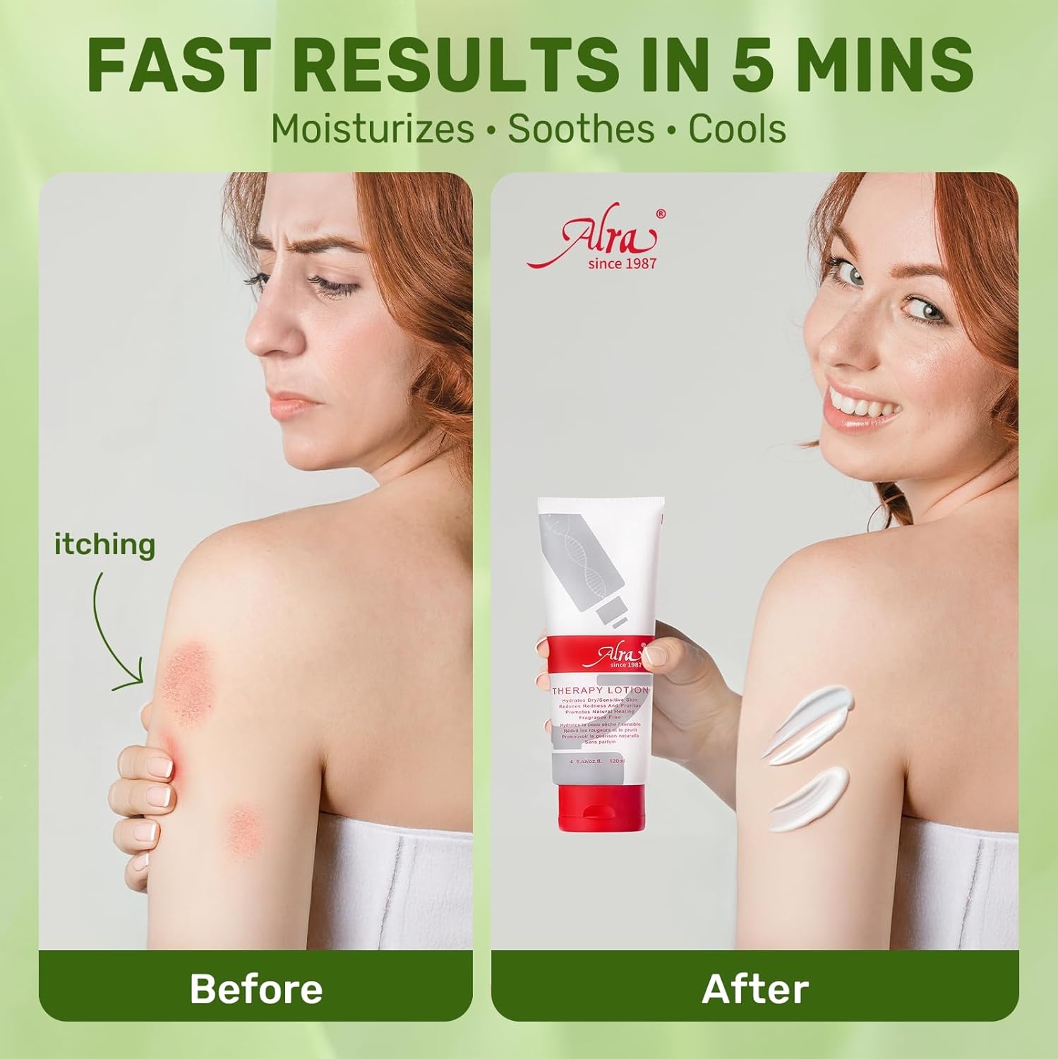 Alra Lotion for Extremely Dry Skin, Face, Hands & Body Cream Moisturizer with Aloe Vera Gel + Lanolin Oil + VE, Itch Relief, After Sun Lotion with Hydrate, Soothe, Cool Benefits, Fragrance free, 4 oz - Image 4