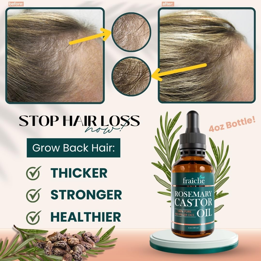 Live Fraiche Rosemary Castor Oil for Hair Growth 4 Ounce - Cold Pressed Castor Oil and Rosemary Oil for Damaged Hair to Reduce Hair Loss - Image 2