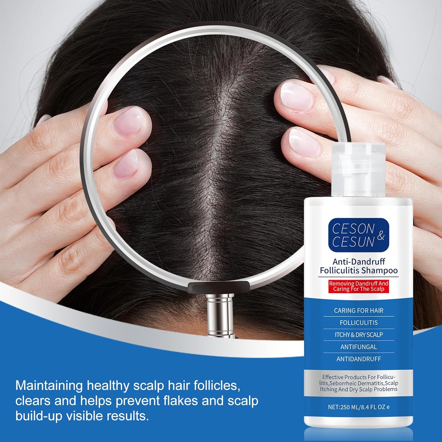 Ceson&Cesun Anti-Fungal/Anti Dandruff 2 in 1 Shampoo for Folliculitis, Scalp Psoriasis & Seborrheic Dermatitis, Itchy & Dry Scalp Relief, Nourishes, Hydrates, Control Oil, Safe For Color-Treated Hair - Image 11