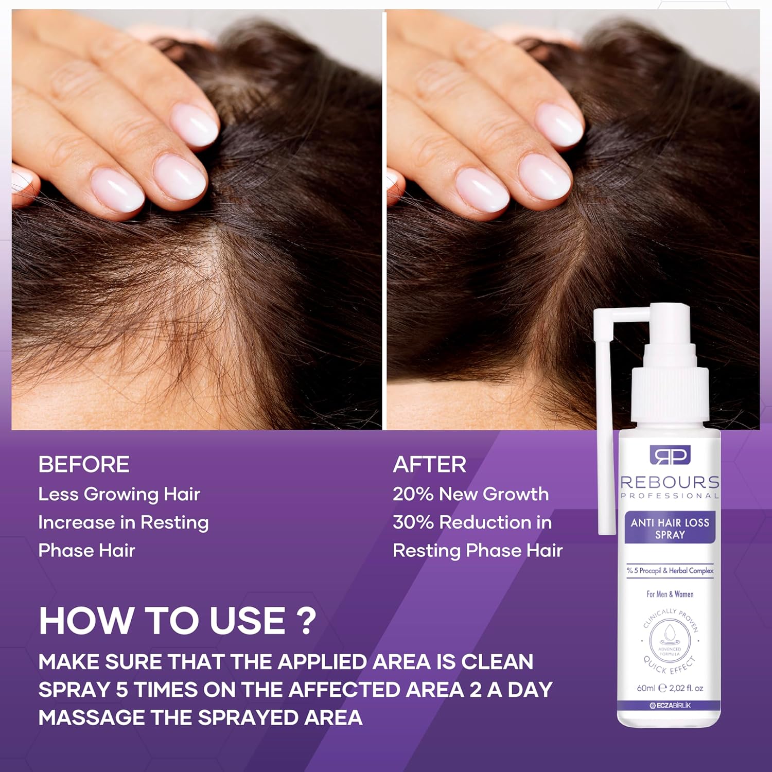 100ml Hair Regrowth Treatment Spray for All Hair Types with 5% Procapil - Image 6