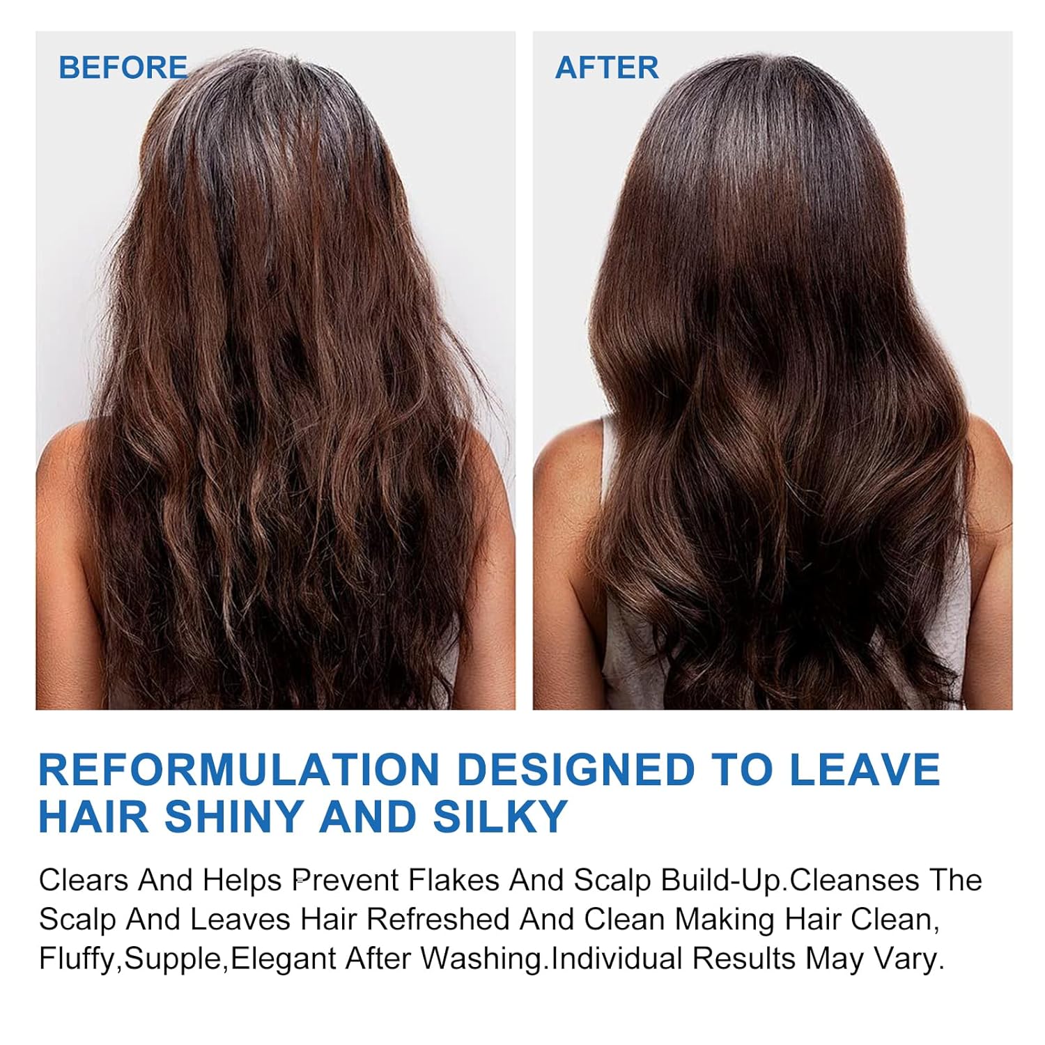 Ceson&Cesun Anti-Fungal/Anti Dandruff 2 in 1 Shampoo for Folliculitis, Scalp Psoriasis & Seborrheic Dermatitis, Itchy & Dry Scalp Relief, Nourishes, Hydrates, Control Oil, Safe For Color-Treated Hair - Image 7