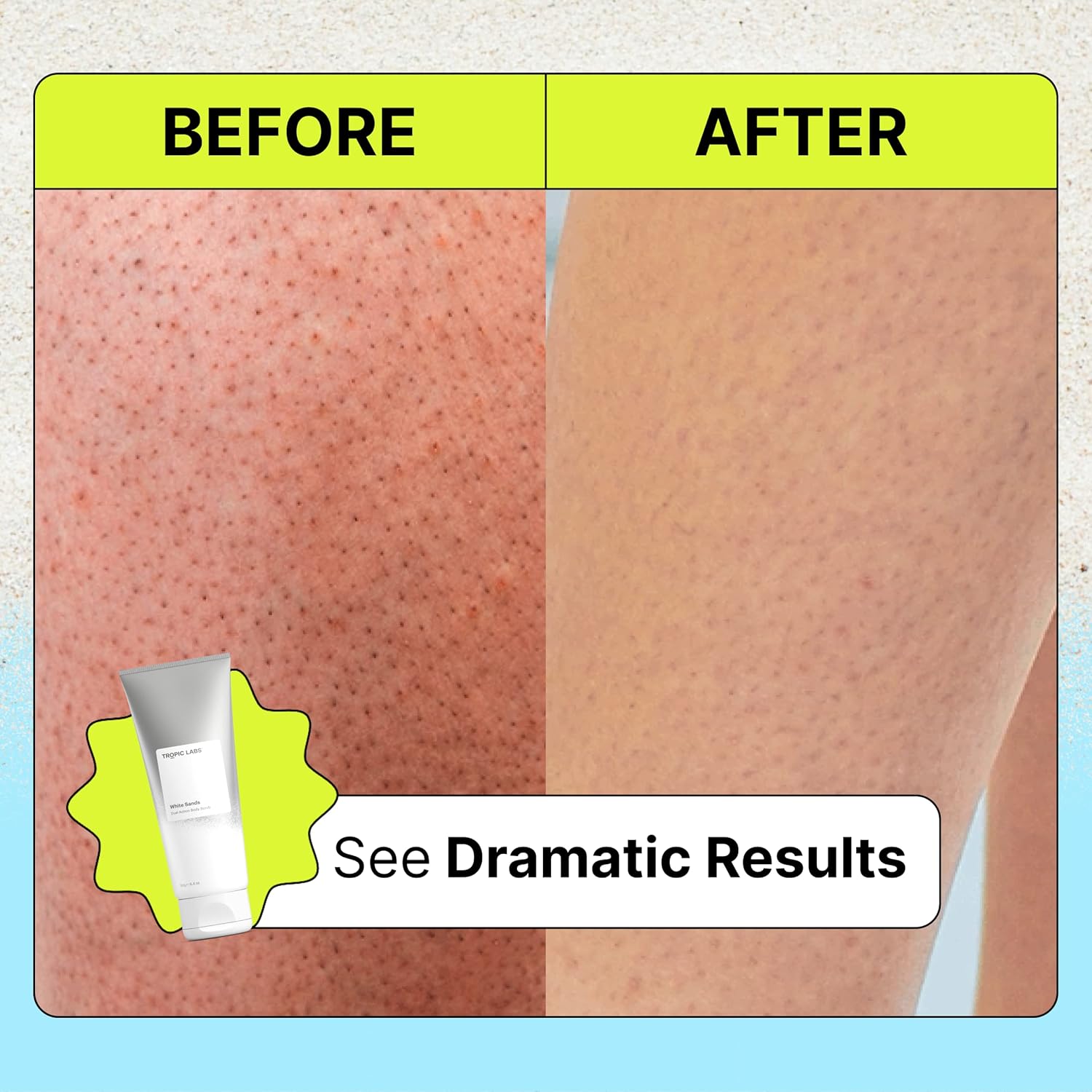 TROPIC LABS White Sands Dual-Action Body Scrub - Sensitive Skin Exfoliating Treatment for Keratosis Pilaris, Strawberry Legs, Bikini Bump Eraser, Body Care For Women 6.4oz. - Image 4
