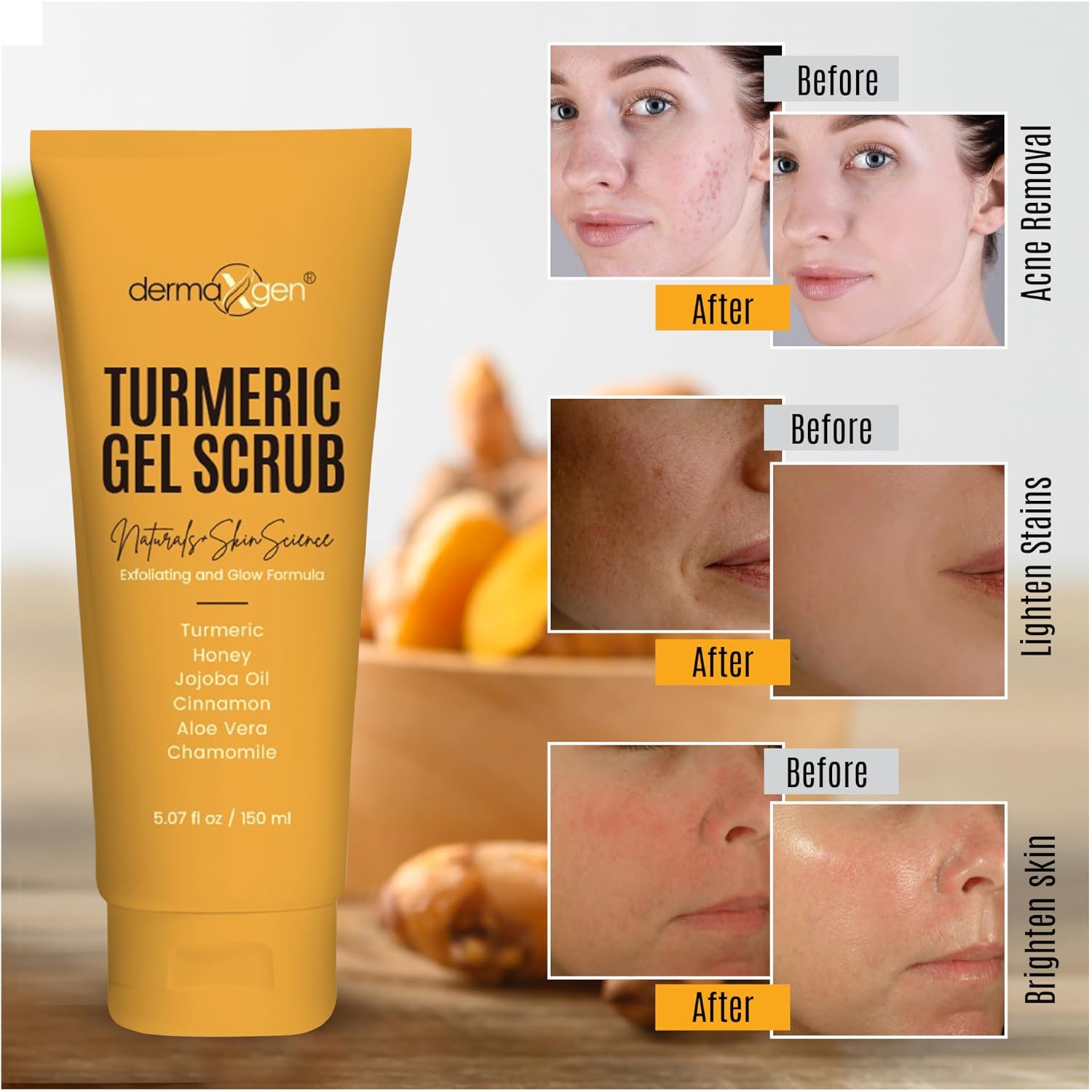 Turmeric Gel Scrub โ Exfoliate, Brighten, and Refresh Your Skin with Turmeric. Achieve a Smooth, Radiant Complexion by Removing Dead Skin Cells and Impurities for a Natural Glow - Image 5