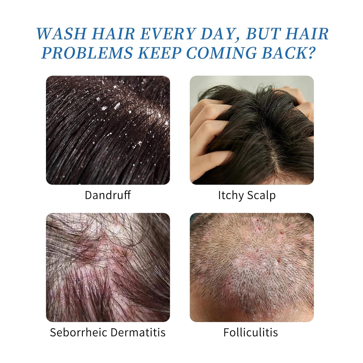 Ceson&Cesun Anti-Fungal/Anti Dandruff 2 in 1 Shampoo for Folliculitis, Scalp Psoriasis & Seborrheic Dermatitis, Itchy & Dry Scalp Relief, Nourishes, Hydrates, Control Oil, Safe For Color-Treated Hair - Image 4