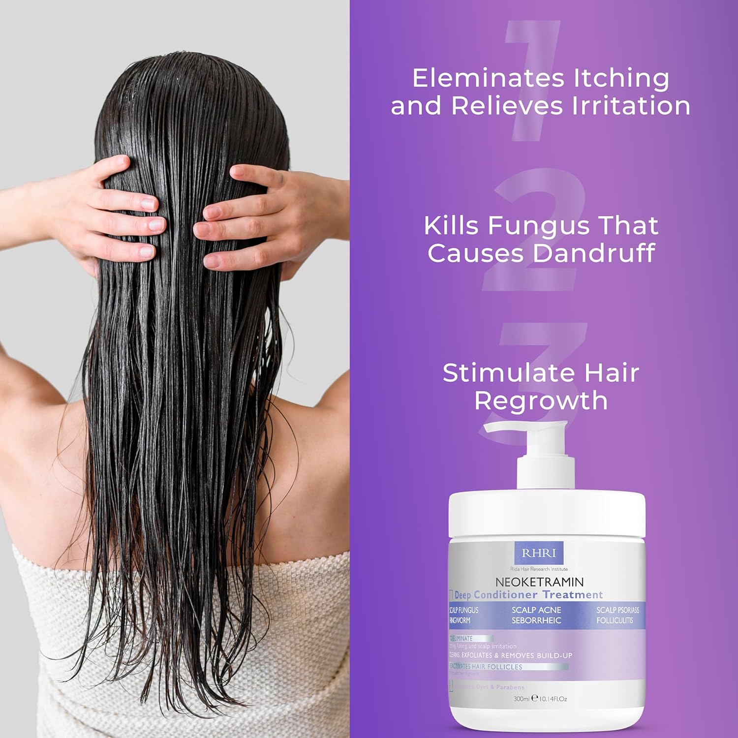 Anti Fungal Deep Conditioner for Men and Women | Scalp Treatment for Psoriasis, Dandruff, Seborrheic Dermatitis | Provides Relief from Folliculitis, Eczema, Itchy, Flaky and Dry Scalp - Image 5