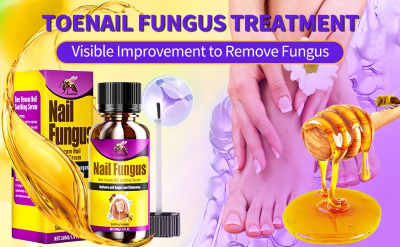 Toenail Fungus Treatment