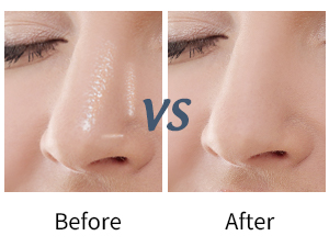 blotting paper sheets
