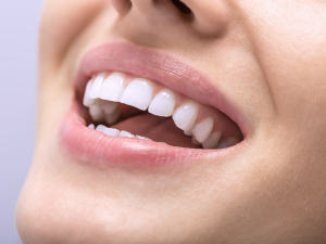 Best teeth whitening gel, Fast-acting teeth whitening gel, Effective teeth whitening, 
