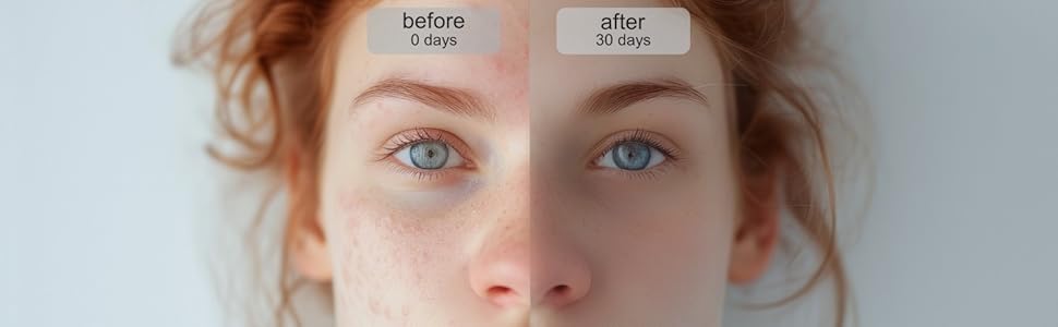 kojic acid soap before and after results