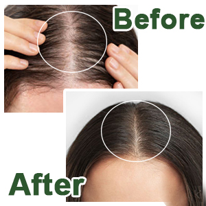black castor oil
