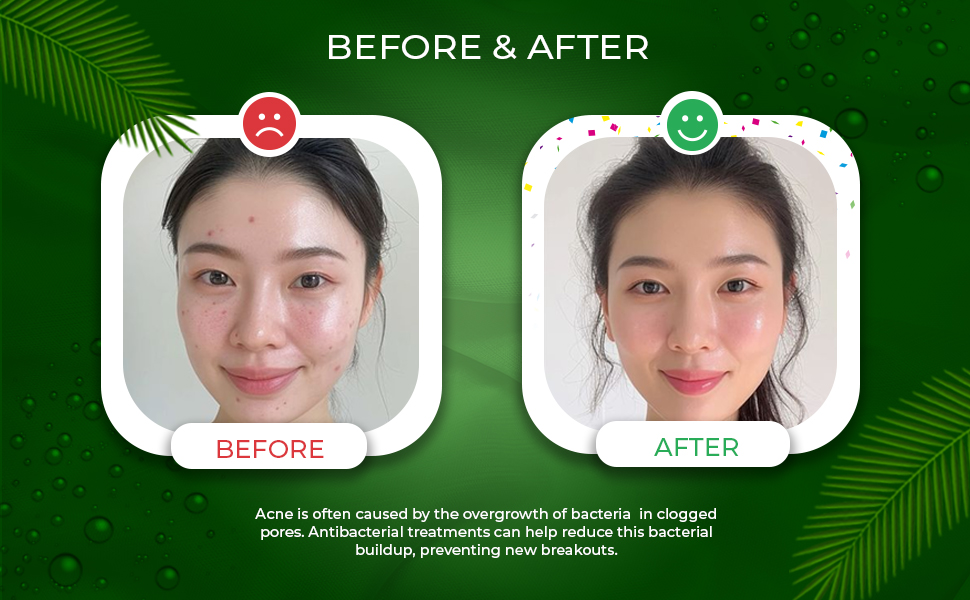 Itching, irritation, eczama, dandruff, odor, athlete foot, antibacterial, antifungal