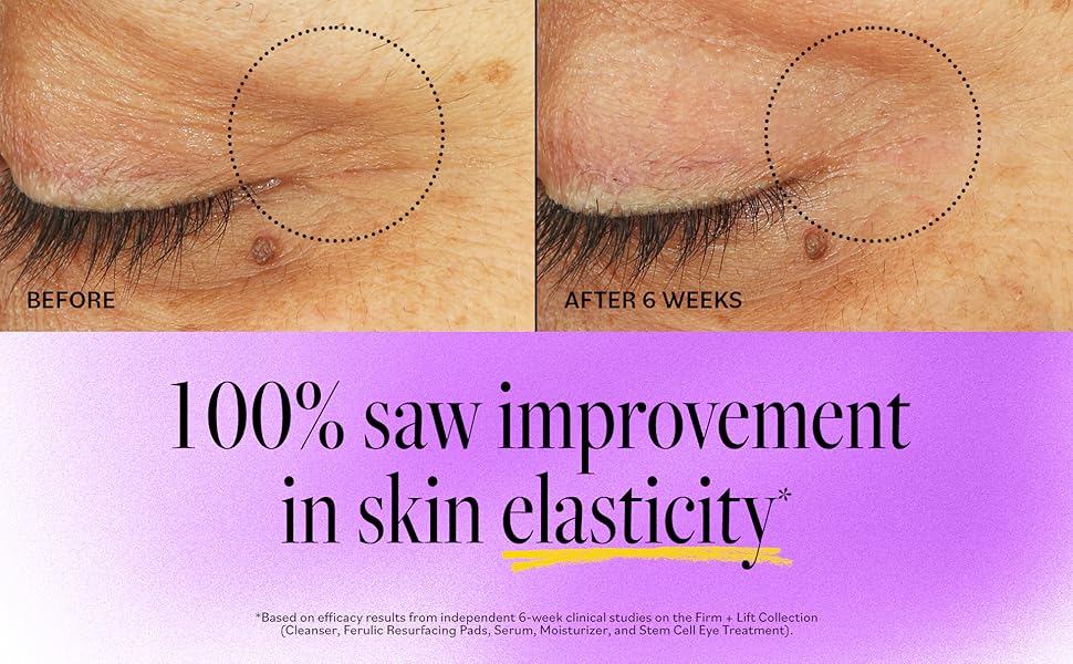 100% saw improvement in skin elasticity