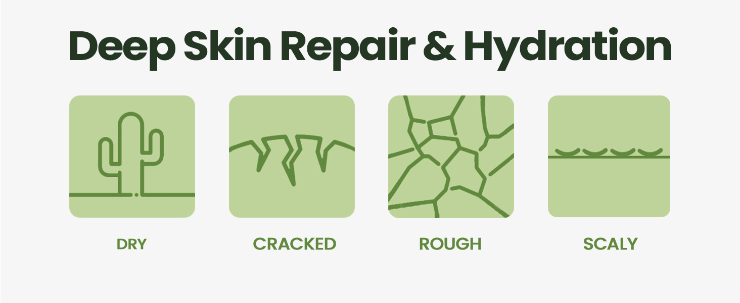 foot cream for dry cracked rough scaly