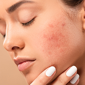 Aloe Hyaluron Cream 4