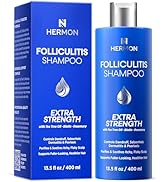 Hermon Folliculitis Shampoo for Itchy Scalp: Psoriasis, Dandruff & Seborrheic Dermatitis – Medica...