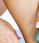 Skin Solutions