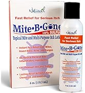 Mite-B-Gone 10% Sulfur Lotion | Itch Relief for Insect Bites, Acne, Itching, Irritation & Redness...