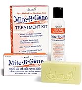 All Natural After Bite Care by Mite-B-Gone - Anti-Itch Sulfur 4 oz Lotion + 1 Soap | Treatment Ki...