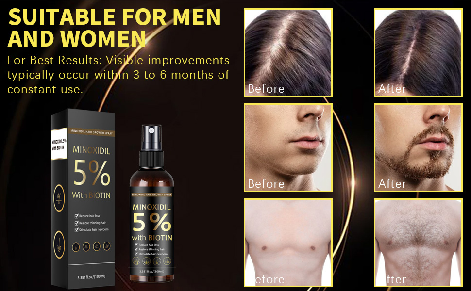 Minoxidil;Biotin;resulting in noticeably thicker, fuller, stronger, longer, and healthier hair.