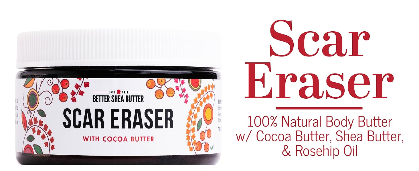 scar cream stretch mark cream stretch mark cream remover acne scar cream