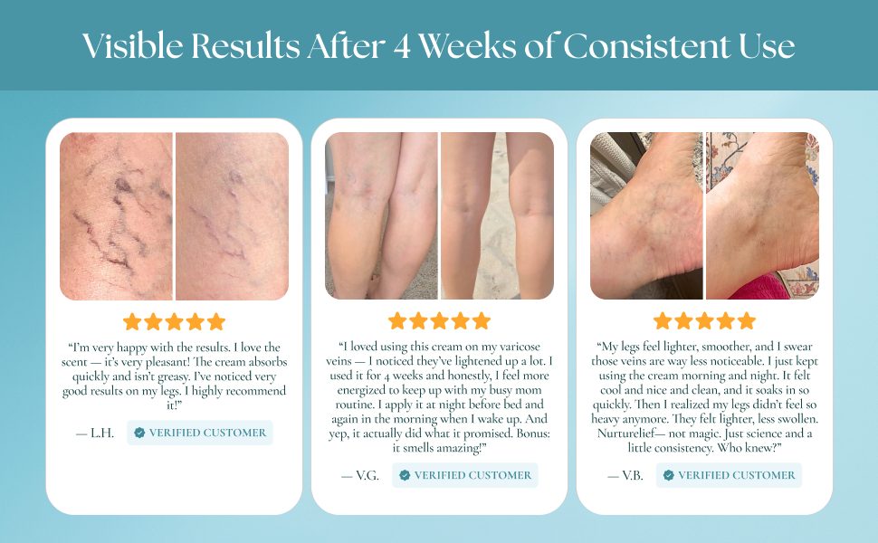 Vein cream results with customer reviews