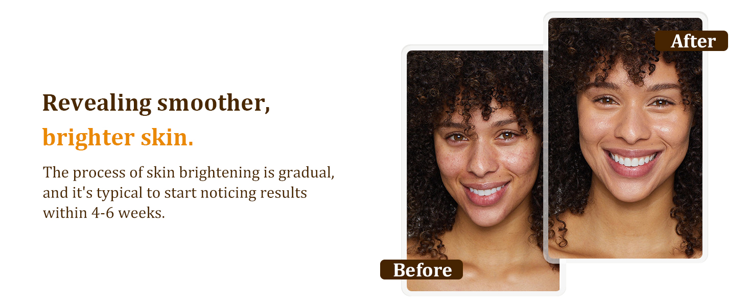 dark spot remover