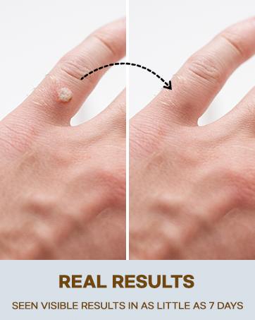 before and after