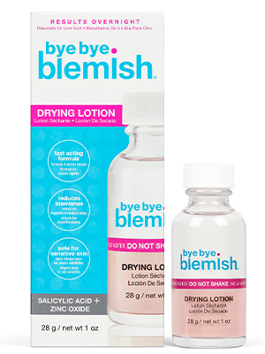 Bye Bye Blemish Acne Drying Lotion
