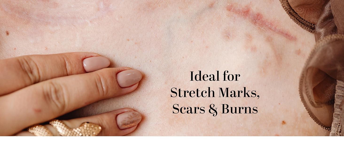 acne scar removal stretch mark removal cream crema para las estrias