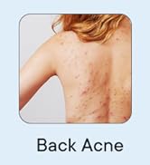 advanced antifungal body wash