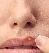 Abreva Cold Sore Med Size .07 Abreva Cold Sore Treatment Cream