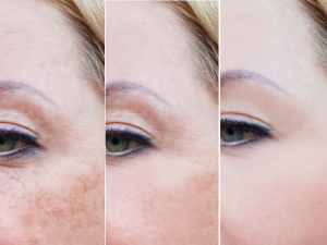 Before and after