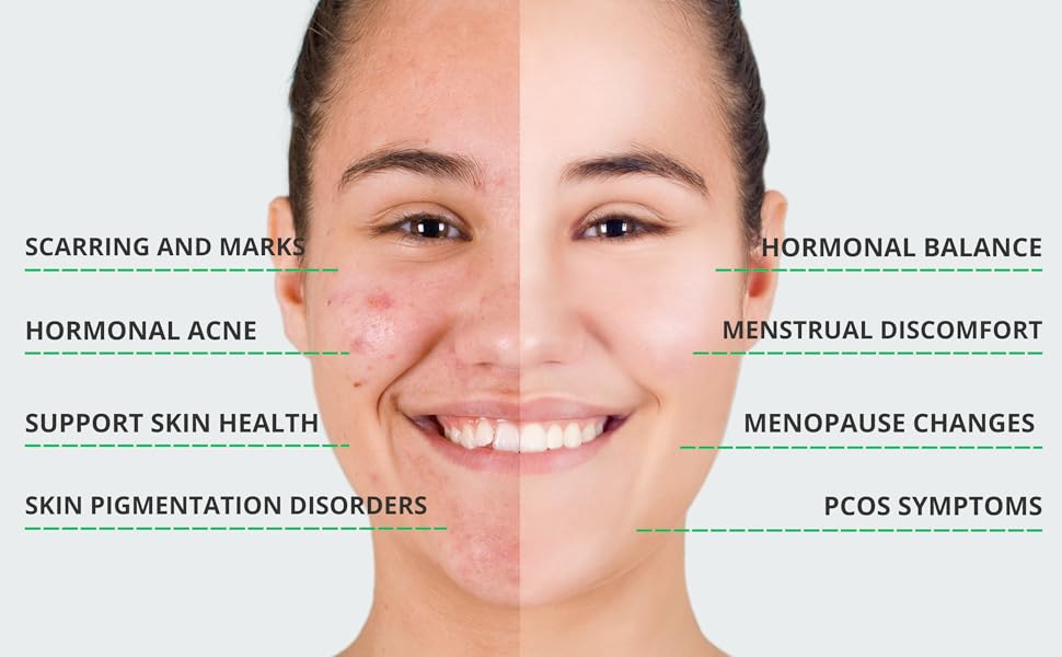 hormonal balance, wild yam cream, hormonal cream, pcos symptoms
