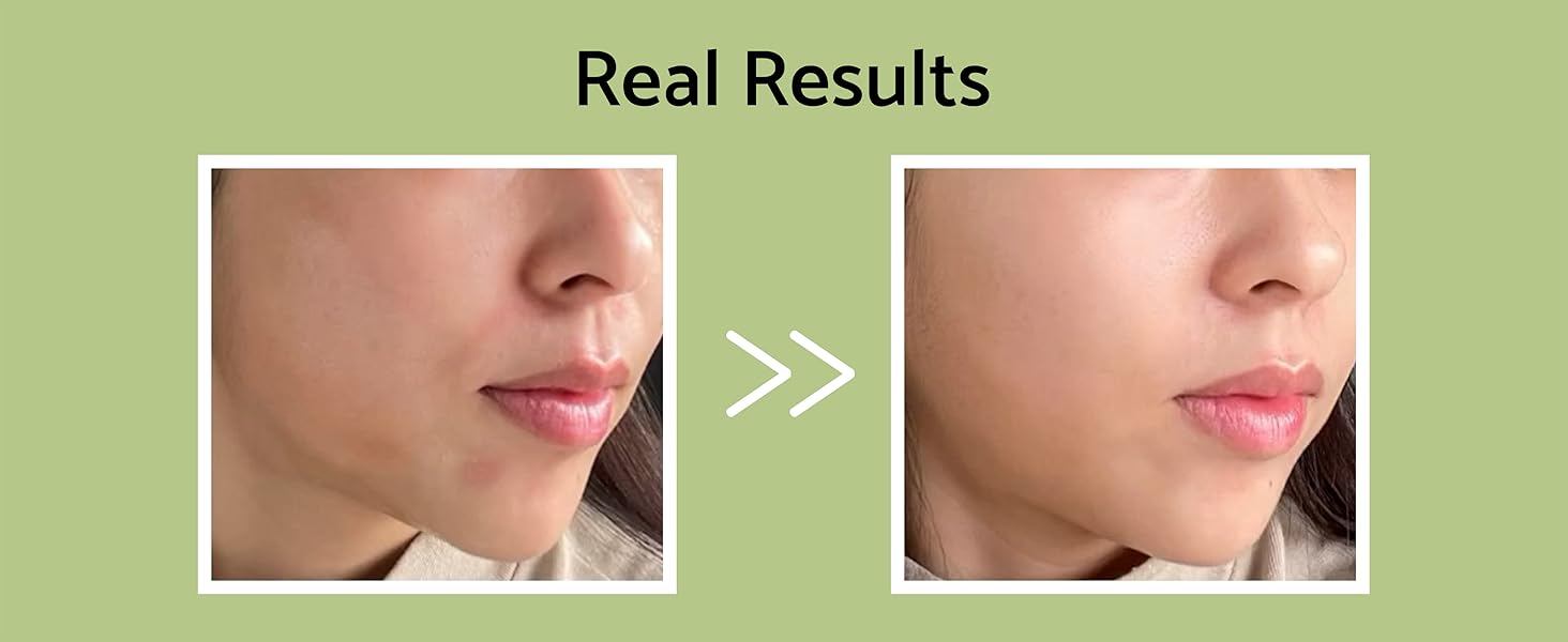 Visible Improvements After Regular Use Clear Radiant Glass Glowing Skin