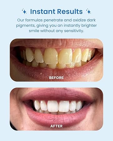 Instant Results—Before & After Shot