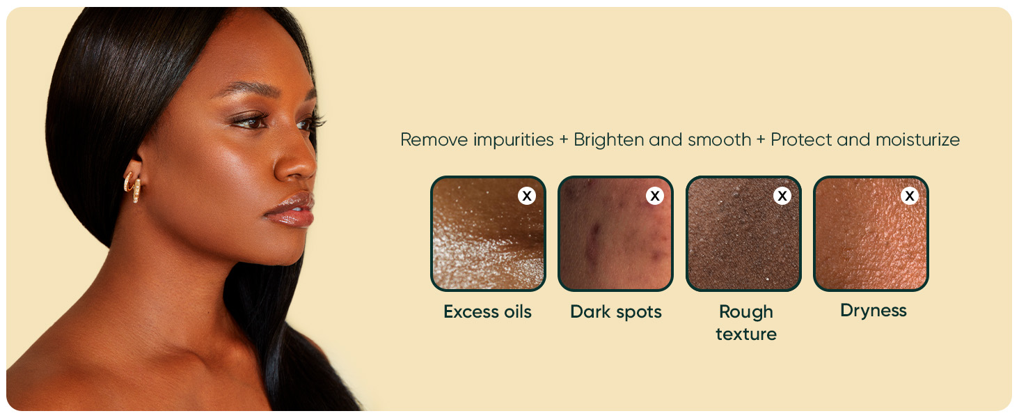 Fights back excess oils, dark spots, rough texture and dryness