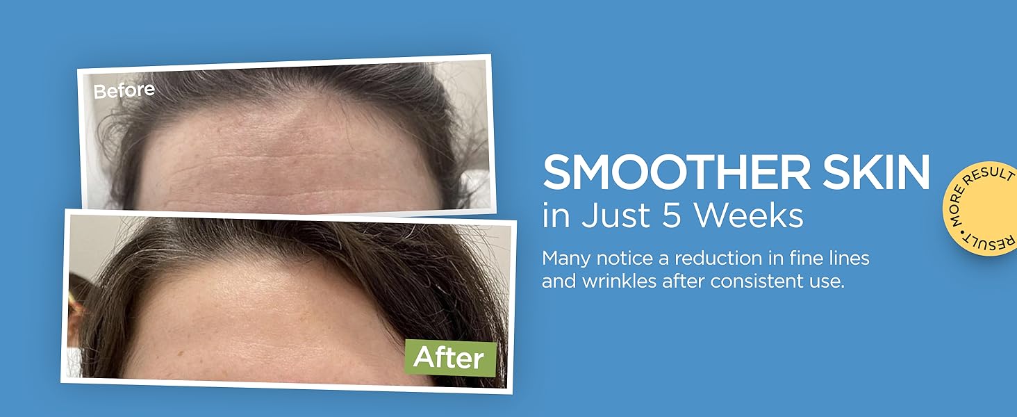 Collagen Face Moisturizer