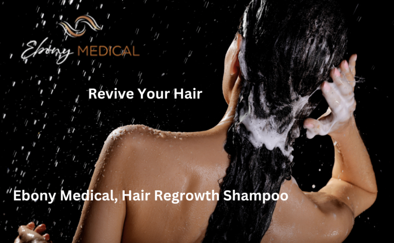 Alopecia Treatment